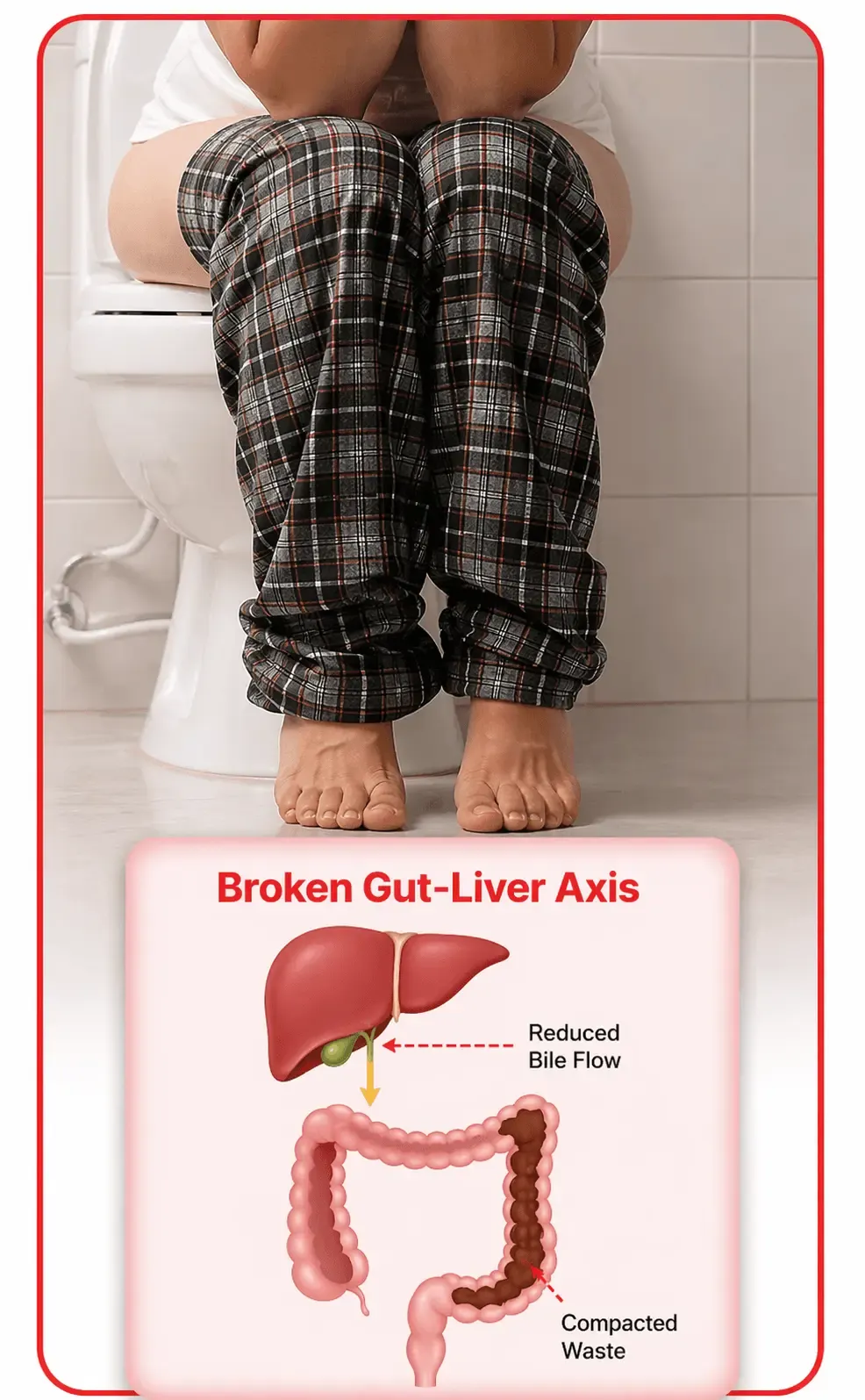 Prostate diagram